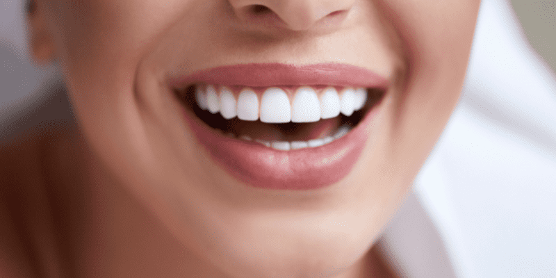 Dental Aesthetics in Almería