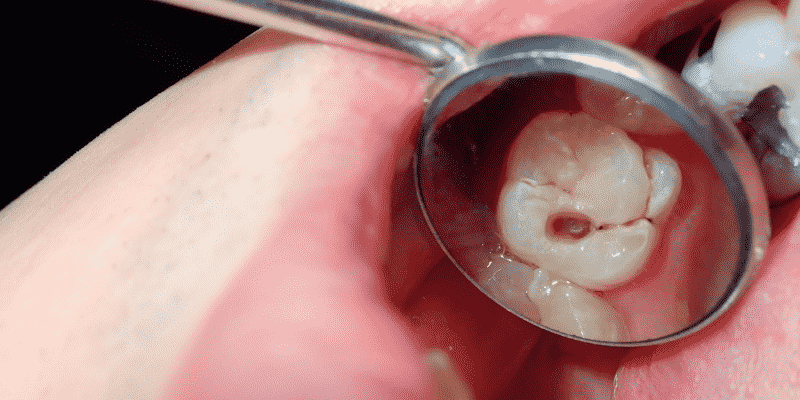 Conservative Dentistry