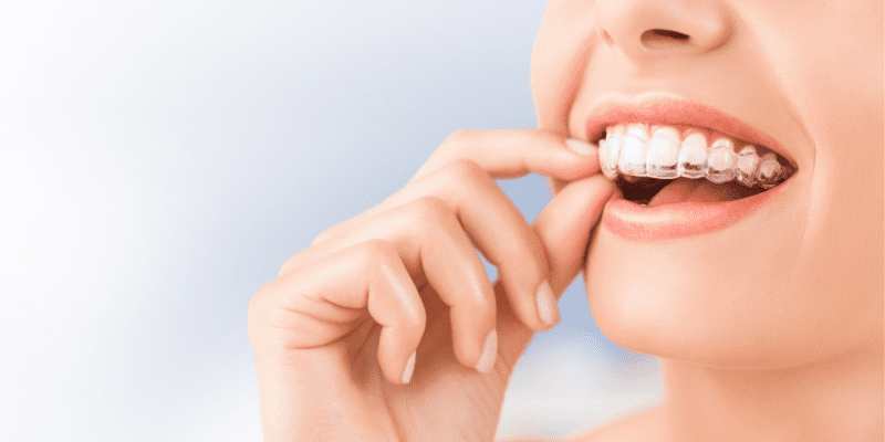 Orthodontics in Almería